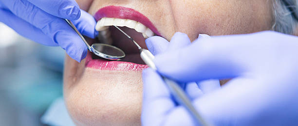 Best Emergency Root Canal Treatment in Roman Forest, TX